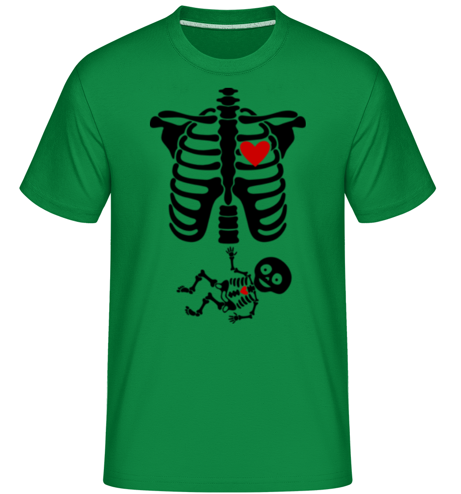 Vert irlandais